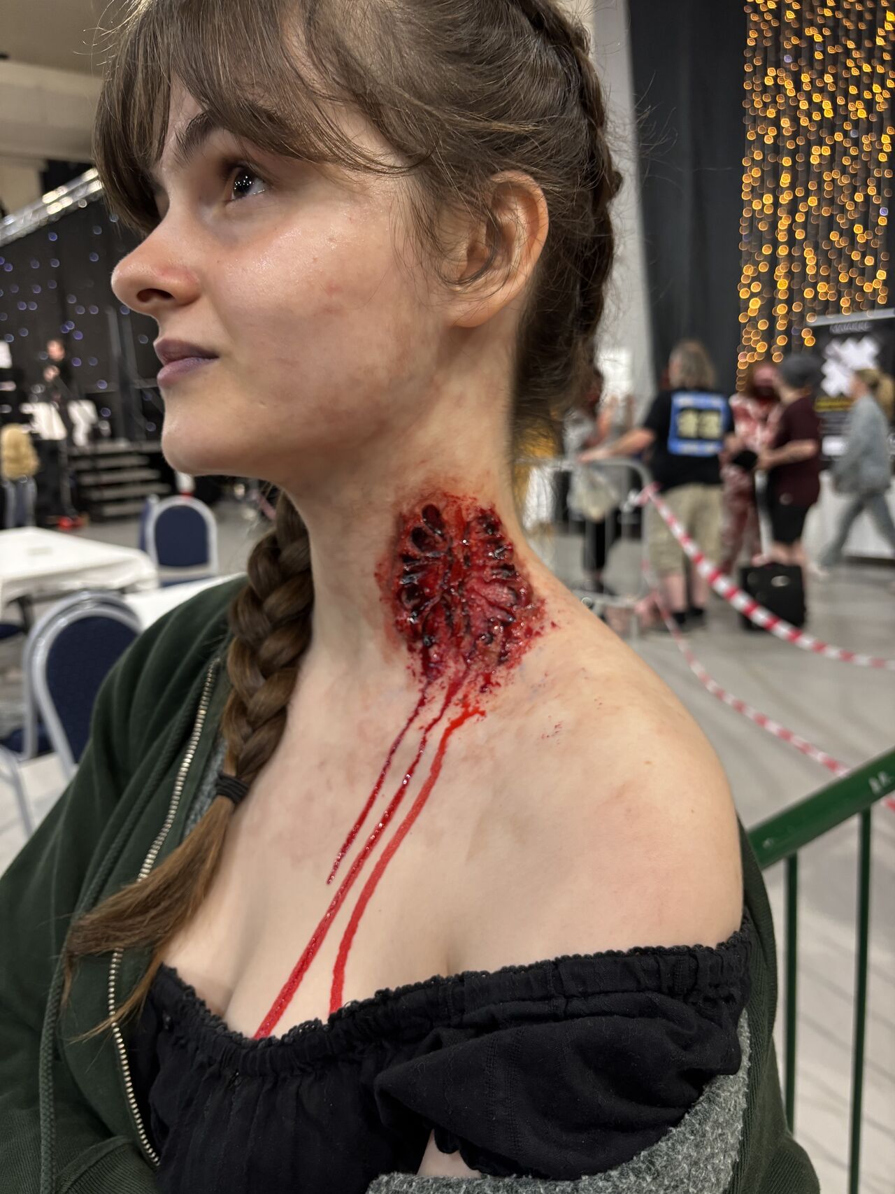 Student with a prosthetic neck wound